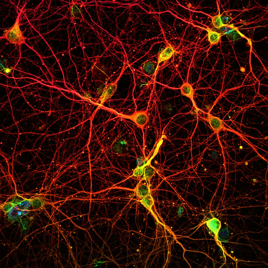 Microscopic image of mouse neurons (made visible with fluorescent dye), showing nodes connected by filaments in a network
